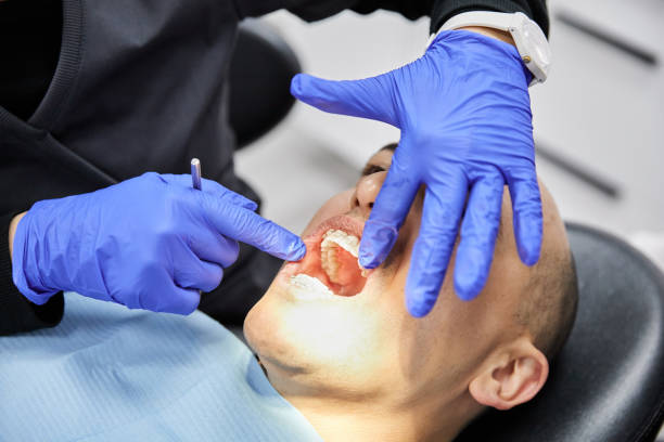 Best Knocked-Out Tooth (Avulsed Tooth) Treatment in Mountainhome, PA